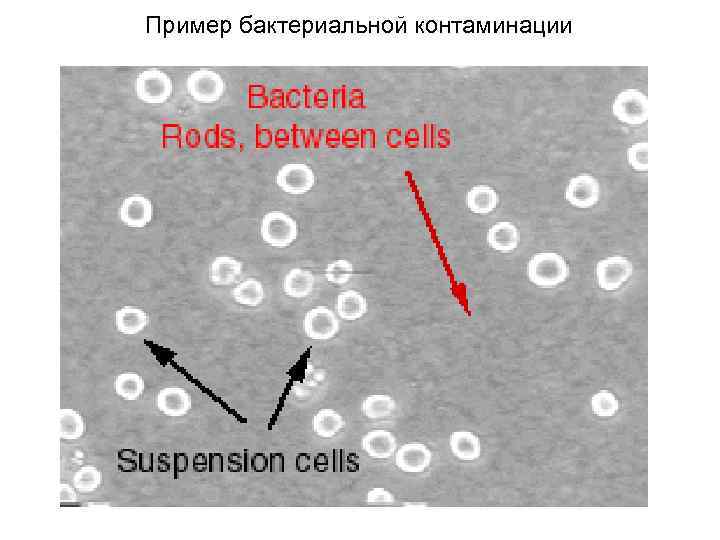 Пример бактериальной контаминации 