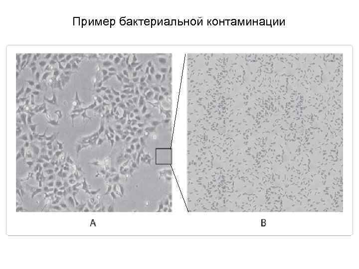 Пример бактериальной контаминации 