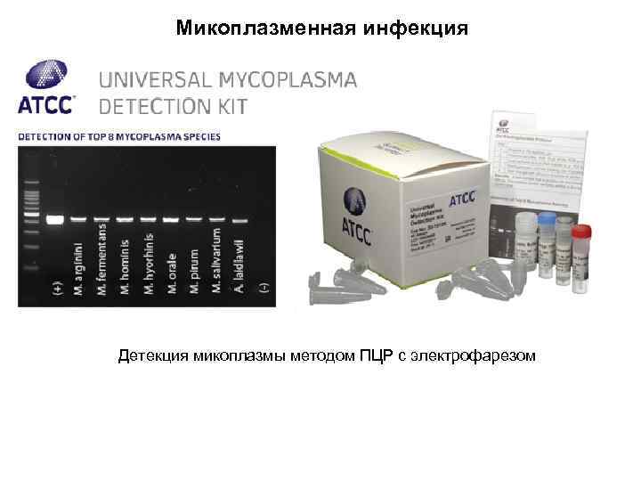 Микоплазменная инфекция Детекция микоплазмы методом ПЦР с электрофарезом 