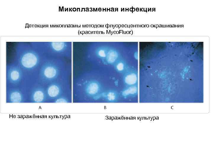 Микоплазменная инфекция Детекция микоплазмы методом флуоресцентного окрашивания (краситель Myco. Fluor) Не заражённая культура Заражённая