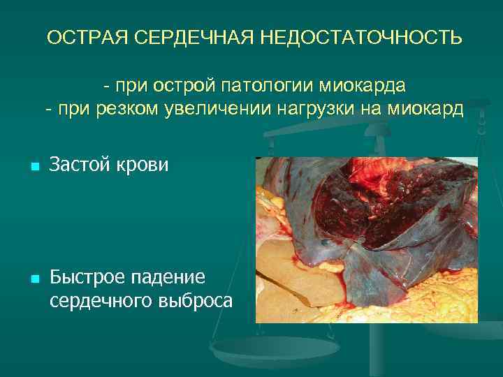 ОСТРАЯ СЕРДЕЧНАЯ НЕДОСТАТОЧНОСТЬ - при острой патологии миокарда - при резком увеличении нагрузки на
