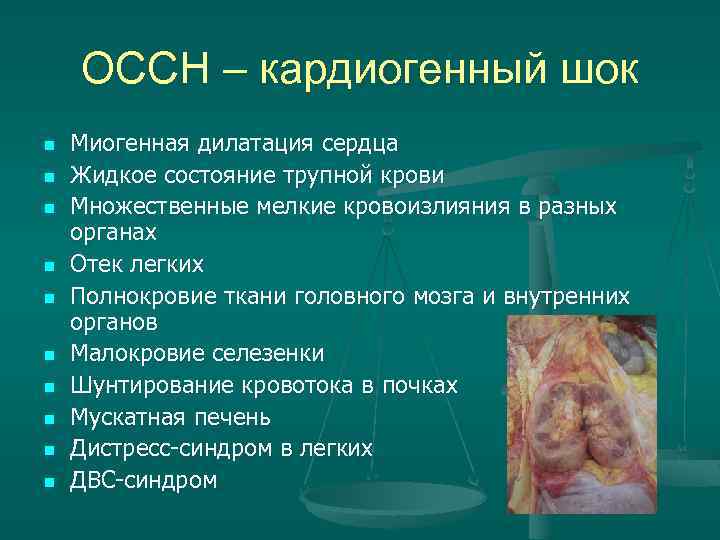 ОССН – кардиогенный шок n n n n n Миогенная дилатация сердца Жидкое состояние
