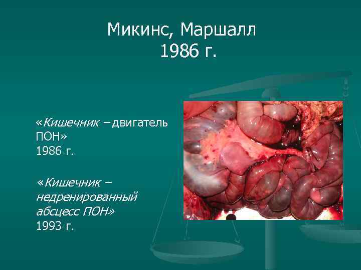 Микинс, Маршалл 1986 г. «Кишечник – двигатель ПОН» 1986 г. «Кишечник – недренированный абсцесс