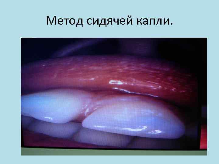 Метод сидячей капли. 
