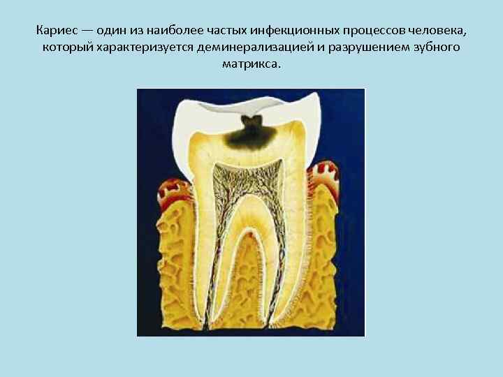 Твердая ткань зуба