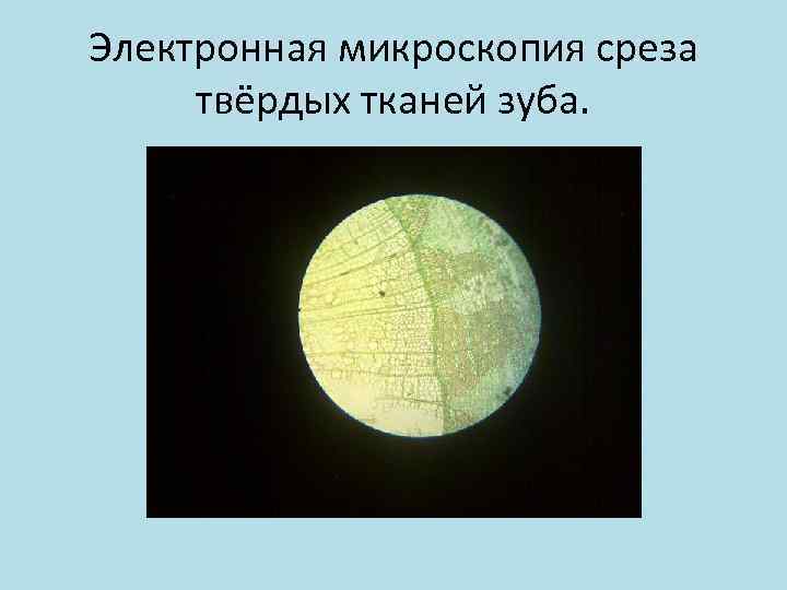 Электронная микроскопия среза твёрдых тканей зуба. 