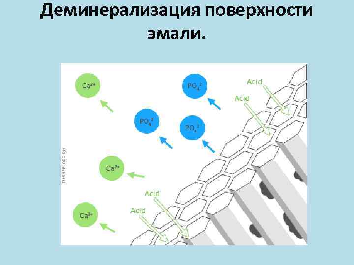 Муаровый рисунок поверхностного слоя эмали обусловлен