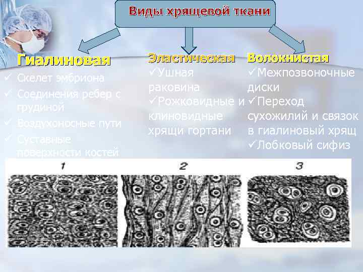 Виды хрящевой ткани Гиалиновая ü Скелет эмбриона ü Соединения ребер с грудиной ü Воздухоносные