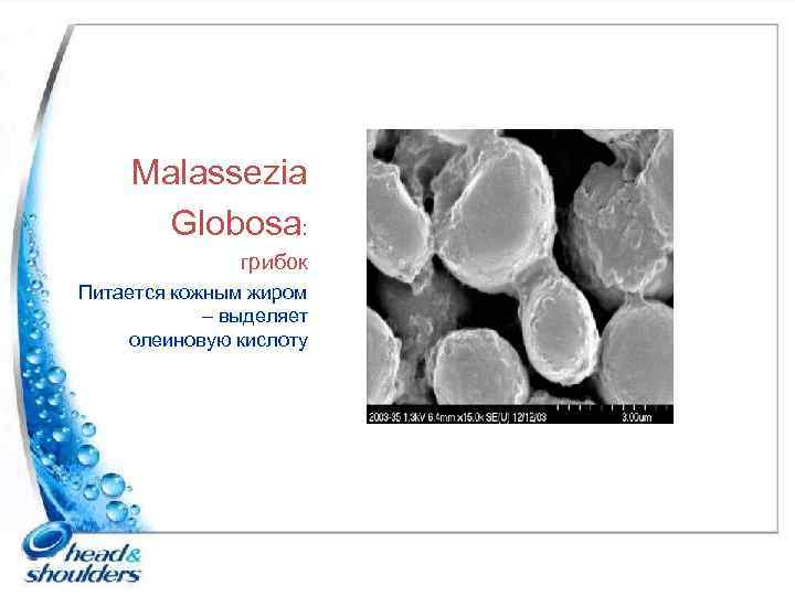 Malassezia Globosa: грибок Питается кожным жиром – выделяет олеиновую кислоту 