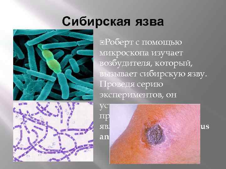 Сибирская язва Роберт с помощью микроскопа изучает возбудителя, который, вызывает сибирскую язву. Проведя серию