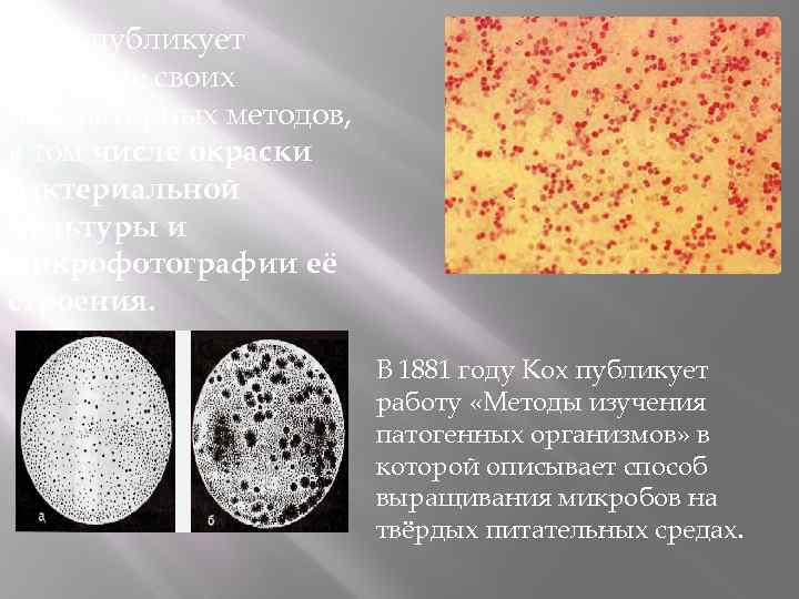  Кох публикует описание своих лабораторных методов, в том числе окраски бактериальной культуры и