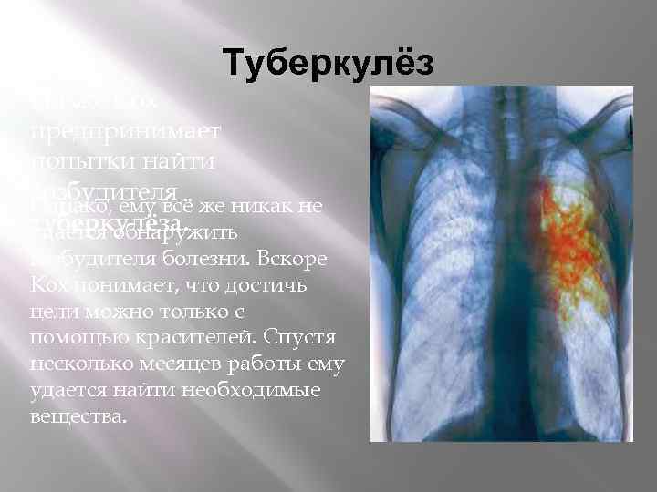 Туберкулёз Позже Кох предпринимает попытки найти возбудителя Однако, ему всё же никак не туберкулёза.