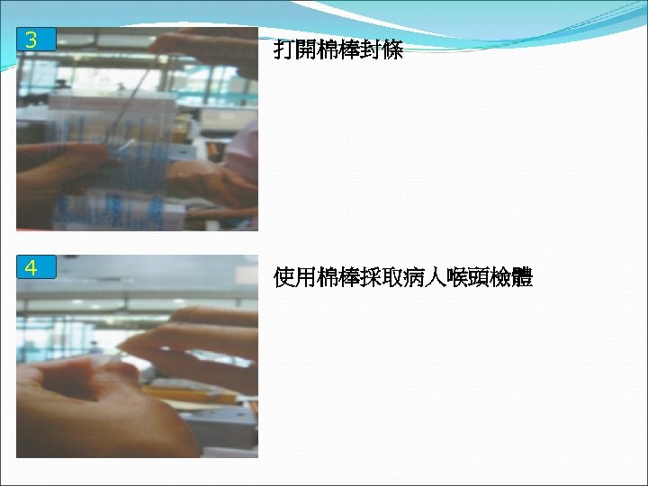 3 打開棉棒封條 4 使用棉棒採取病人喉頭檢體 