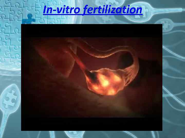 In-vitro fertilization 