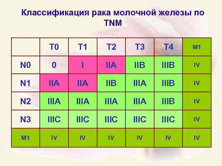 Стадии рака молочной железы. Классификация опухолей молочной железы TNM. ТНМ классификация опухолей молочной железы. Молочная железа классификация ТНМ. TNM классификация РМЖ.