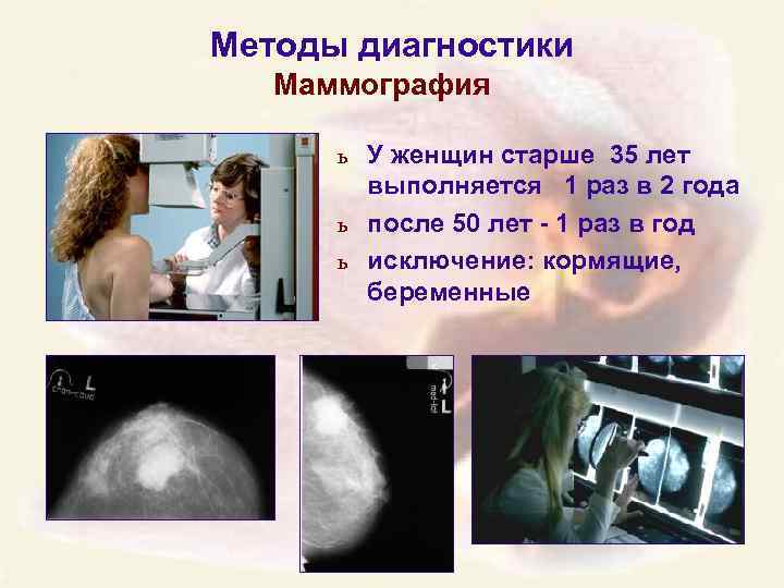 Маммография периодичность. Маммография. Методика проведения маммографии. Маммография женщинам. Маммография молочных желез.