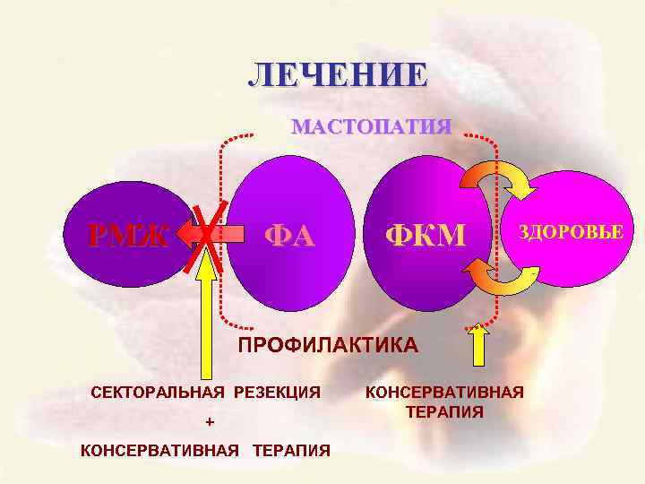 ЛЕЧЕНИЕ МАСТОПАТИЯ РМЖ ФА ФКМ ЗДОРОВЬЕ ПРОФИЛАКТИКА СЕКТОРАЛЬНАЯ РЕЗЕКЦИЯ + КОНСЕРВАТИВНАЯ ТЕРАПИЯ 