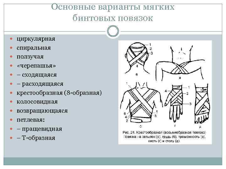 Основные варианты мягких бинтовых повязок циркулярная спиральная ползучая «черепашья» – сходящаяся – расходящаяся крестообразная