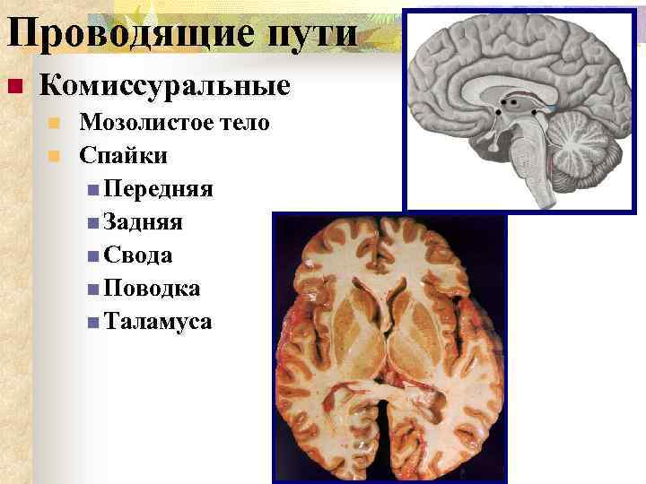 Проводящие пути n Комиссуральные n n Мозолистое тело Спайки n Передняя n Задняя n
