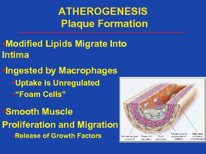 ATHEROGENESIS Plaque Formation • Modified Lipids Migrate Into Intima • Ingested by Macrophages •