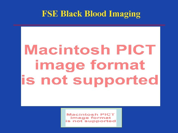 FSE Black Blood Imaging 