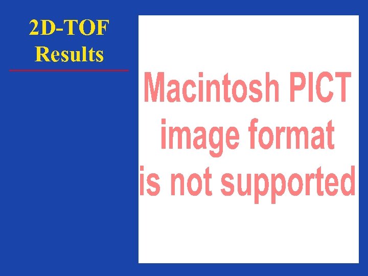 2 D-TOF Results 