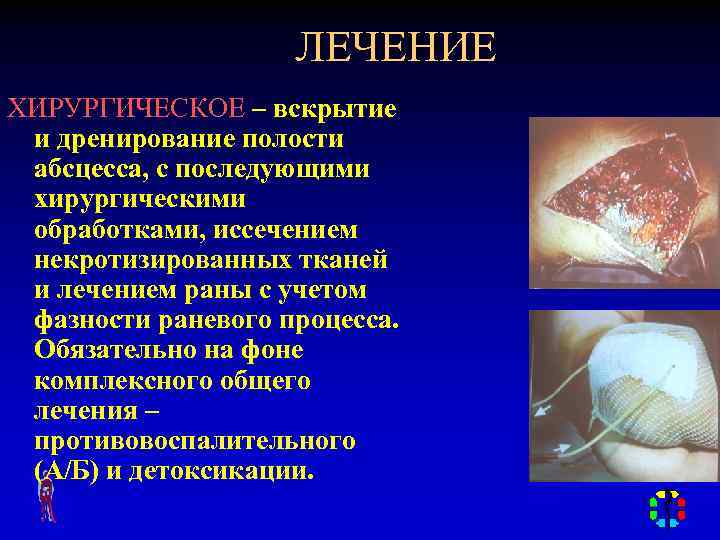 ЛЕЧЕНИЕ ХИРУРГИЧЕСКОЕ – вскрытие и дренирование полости абсцесса, с последующими хирургическими обработками, иссечением некротизированных