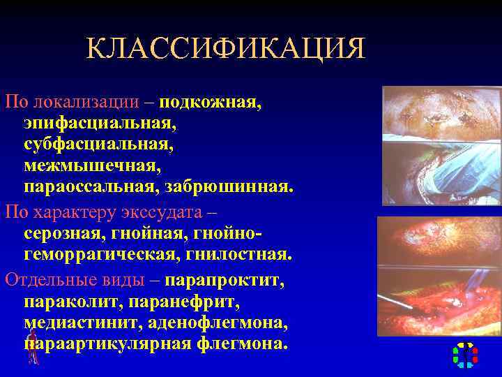 КЛАССИФИКАЦИЯ По локализации – подкожная, эпифасциальная, субфасциальная, межмышечная, параоссальная, забрюшинная. По характеру экссудата –