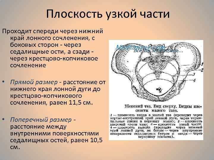 Нижний край. Плоскость выхода малого таза. Плоскость узкой части малого таза. Прямой размер плоскости широкой части малого таза. Плоскость узкой части малого таза Размеры.