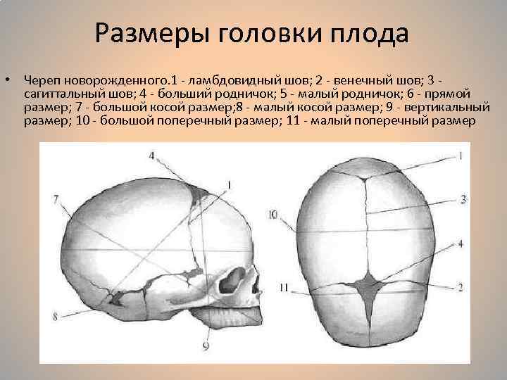 Размеры головки плода • Череп новорожденного. 1 - ламбдовидный шов; 2 - венечный шов;