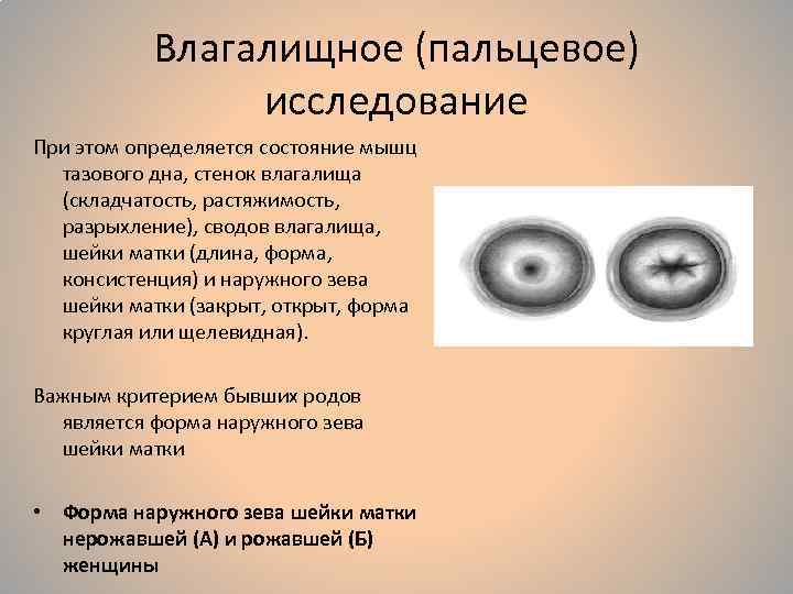 Влагалищное (пальцевое) исследование При этом определяется состояние мышц тазового дна, стенок влагалища (складчатость, растяжимость,