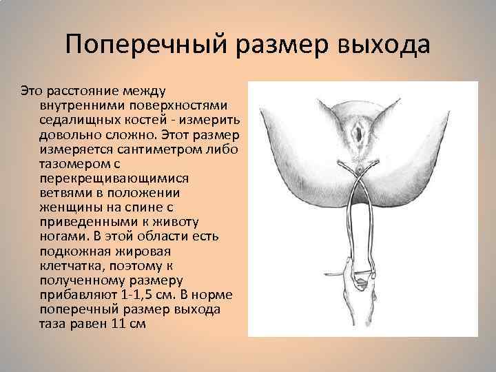 Поперечный размер выхода Это расстояние между внутренними поверхностями седалищных костей - измерить довольно сложно.