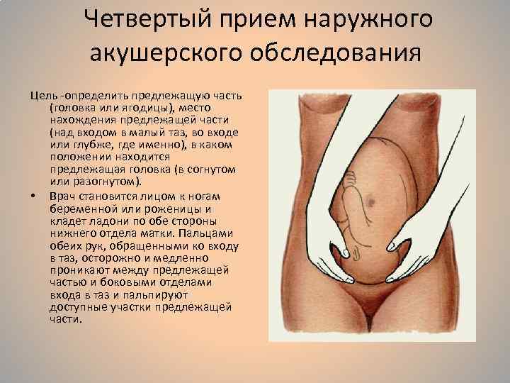Четвертый прием наружного акушерского обследования Цель -определить предлежащую часть (головка или ягодицы), место нахождения