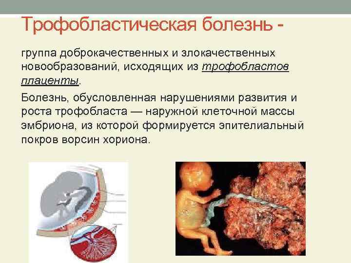 Трофобластическая болезнь группа доброкачественных и злокачественных новообразований, исходящих из трофобластов плаценты. Болезнь, обусловленная нарушениями