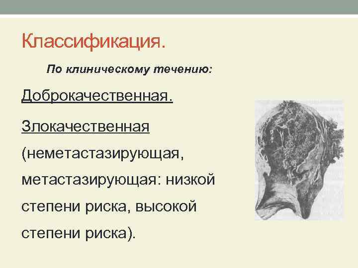 Классификация. По клиническому течению: Доброкачественная. Злокачественная (неметастазирующая, метастазирующая: низкой степени риска, высокой степени риска).