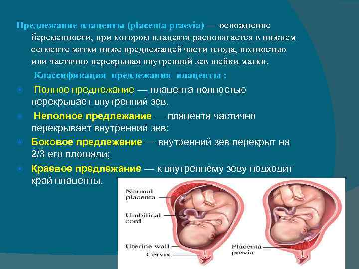 Что значит низкая плацентация при беременности