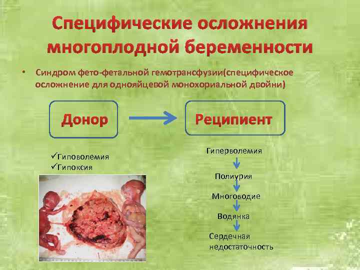 Специфические осложнения многоплодной беременности • Синдром фето-фетальной гемотрансфузии(специфическое осложнение для однояйцевой монохориальной двойни) Донор