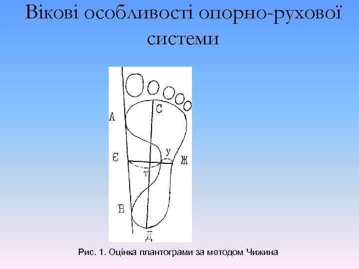 Вікові особливості опорно-рухової системи Рис. 1. Оцінка плантограми за методом Чижина 