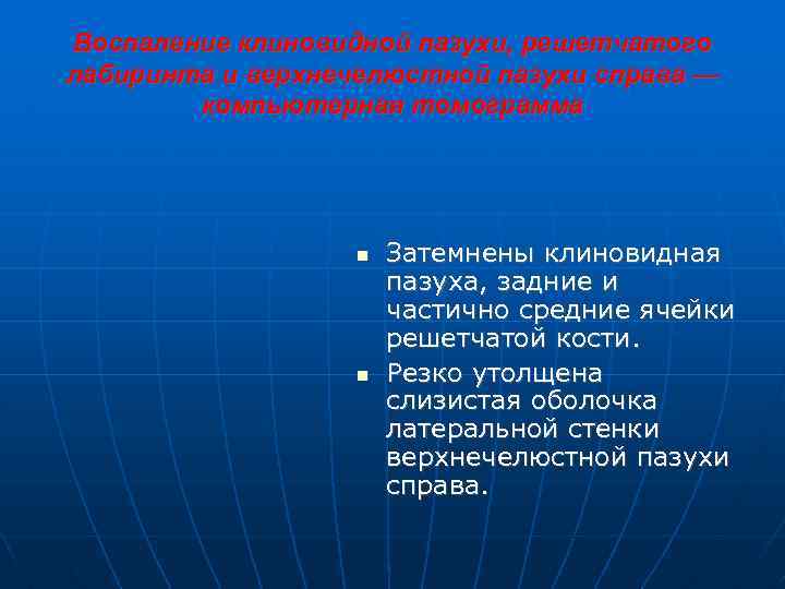 Воспаление клиновидной пазухи, решетчатого лабиринта и верхнечелюстной пазухи справа — компьютерная томограмма Затемнены клиновидная