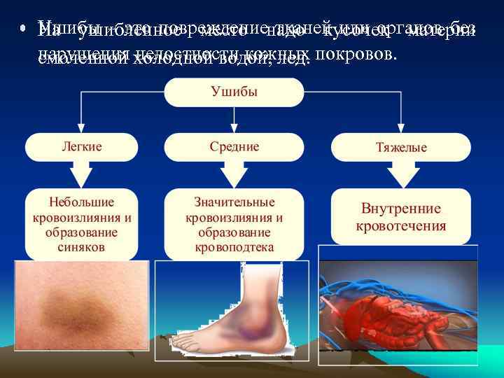  • Ушибы – это повреждениенадо кусочек материи На ушибленное место тканей или органов