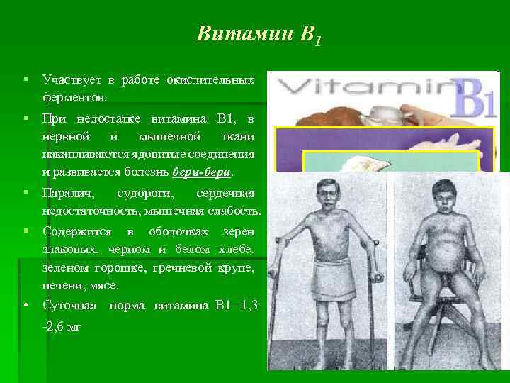 Витамин В 1 § Участвует в работе окислительных ферментов. § При недостатке витамина В