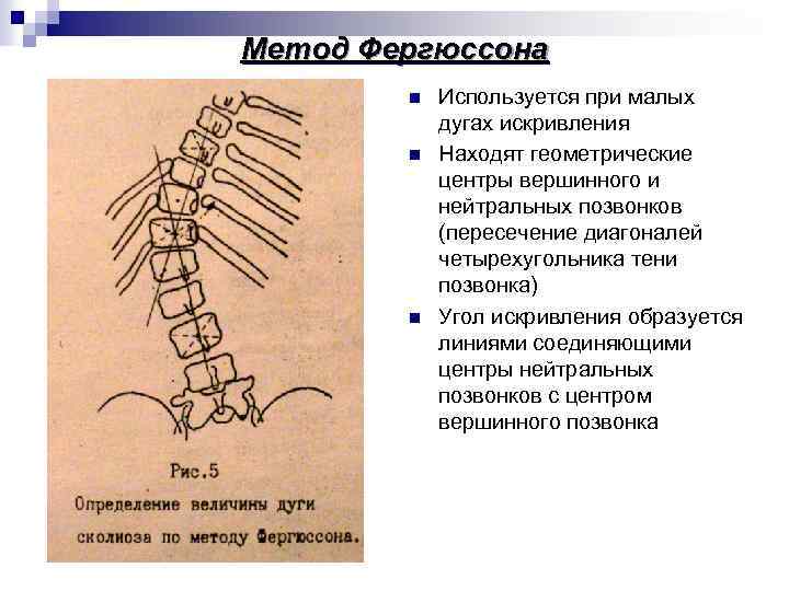 Метод Фергюссона n n n Используется при малых дугах искривления Находят геометрические центры вершинного
