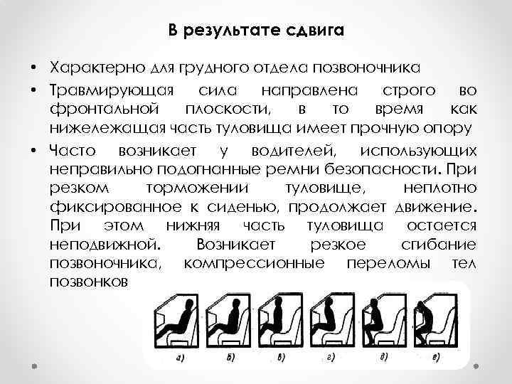 В результате сдвига • Характерно для грудного отдела позвоночника • Травмирующая сила направлена строго