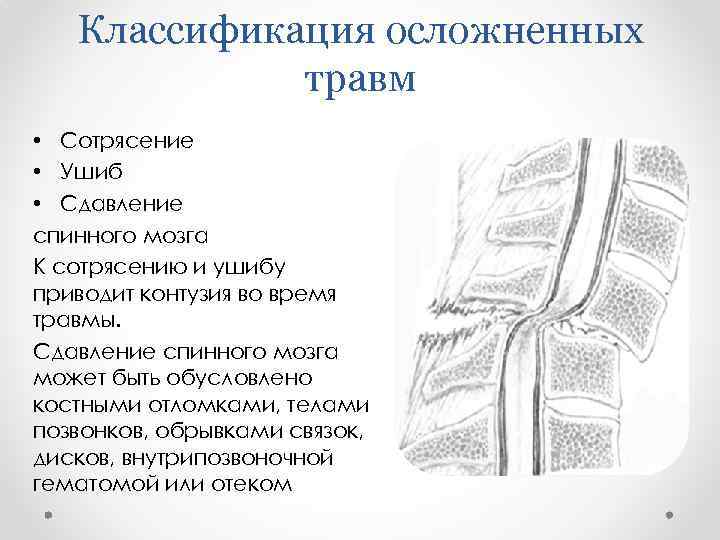 Классификация осложненных травм • Сотрясение • Ушиб • Сдавление спинного мозга К сотрясению и