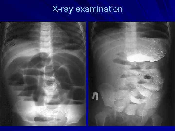 X-ray examination 