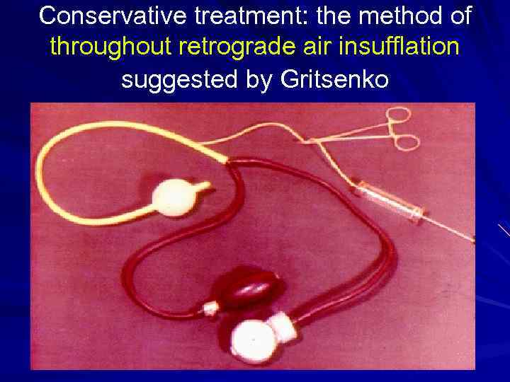Conservative treatment: the method of throughout retrograde air insufflation suggested by Gritsenko 