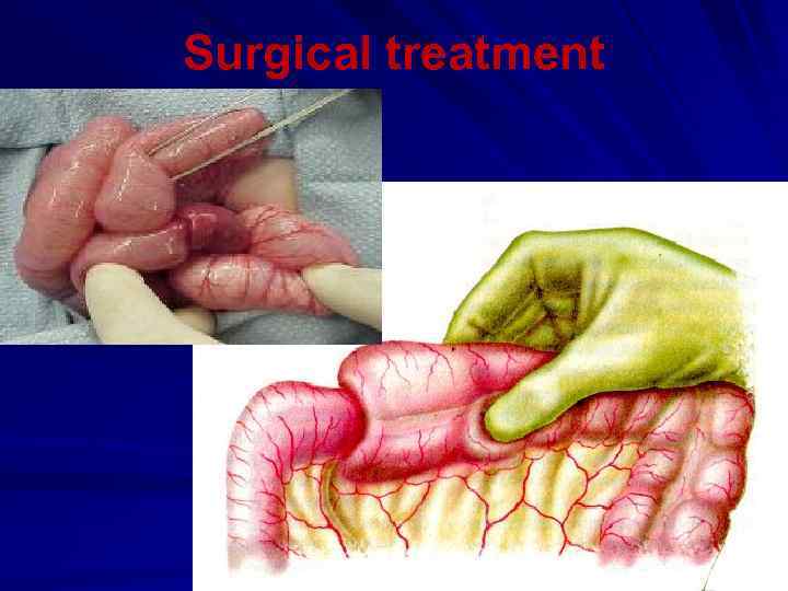 Surgical treatment 