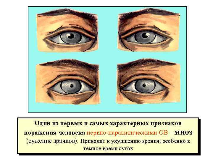 Изображение характерных признаков. Вещества нервно-паралитического действия. Нервно-паралитические отравляющие вещества. Вещества нервно-паралитического действия поражают. Признаки поражения ов нервно-паралитического действия.