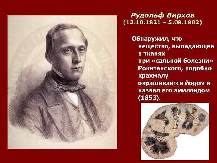Рудольф Вирхов (13. 10. 1821 – 5. 09. 1902) Обнаружил, что вещество, выпадающее в