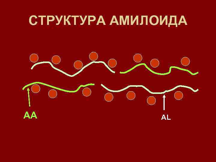 СТРУКТУРА АМИЛОИДА АА AL 